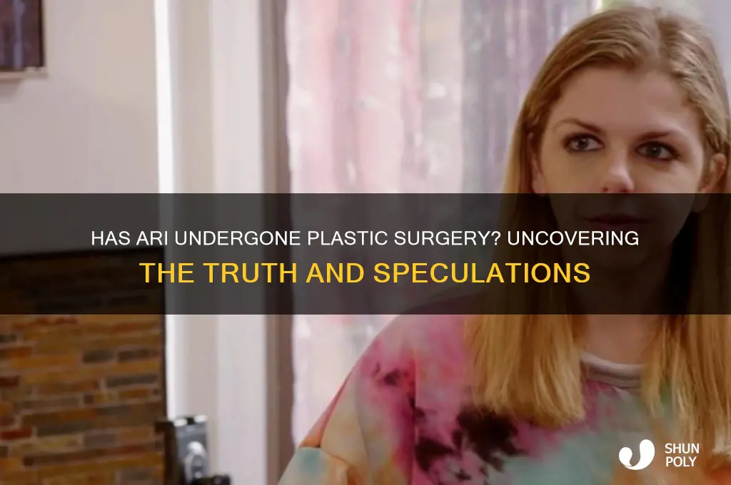 does ari have plastic surgery