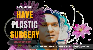 Ash Kaash Plastic Surgery: Fact-Checking the Rumors and Speculations