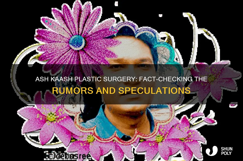 does ash kaash have plastic surgery