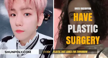 Baekhyun's Transformation: Plastic Surgery Rumors and the Truth Behind Them