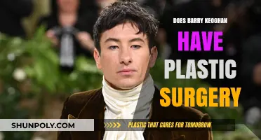 Barry Keoghan's Transformation: Plastic Surgery Rumors Explored