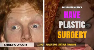 Barry Manilow's Transformation: Plastic Surgery Speculations and Truths