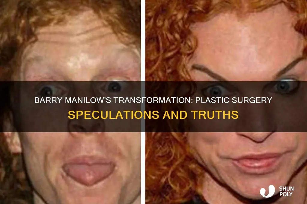 does barry manilow have plastic surgery