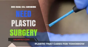 Basal Cell Carcinoma Treatment: When Is Plastic Surgery Necessary?