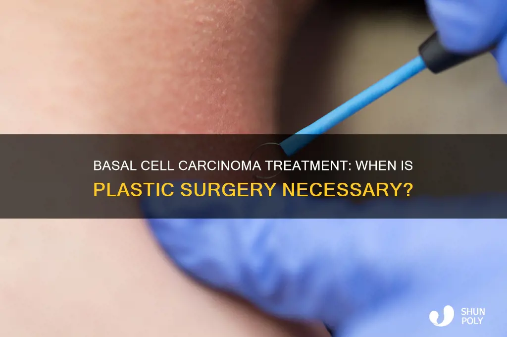 does basal cell carcinoma need plastic surgery