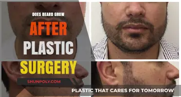 Beard Growth Post-Plastic Surgery: What to Expect and How It Works