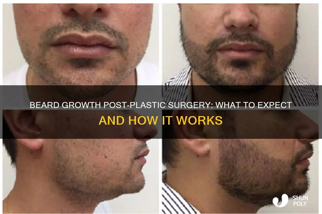does beard grow after plastic surgery