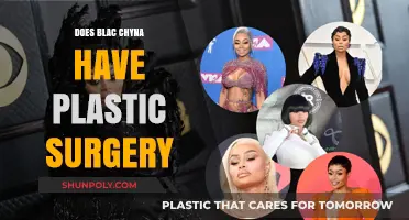Blac Chyna's Transformation: Plastic Surgery Rumors and Reality Revealed
