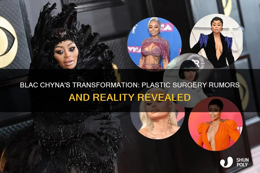 does blac chyna have plastic surgery