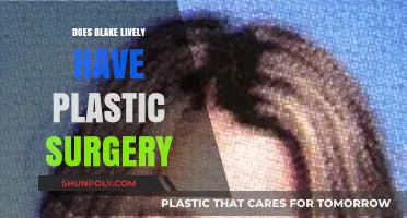 Blake Lively's Transformation: Plastic Surgery Rumors and Realities Explored