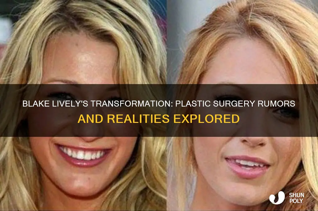 does blake lively have plastic surgery