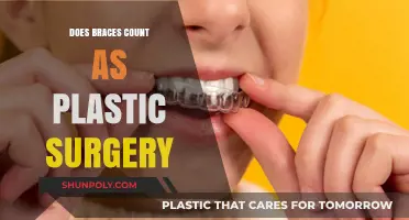 Are Braces Considered Plastic Surgery? Debunking the Myth