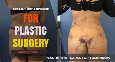 Brazil's Plastic Surgery Reputation: Fact or Fiction?