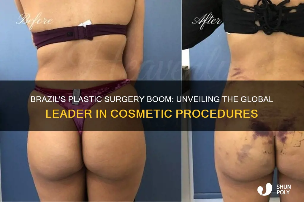 does brazil have the highest plastic surgery rate