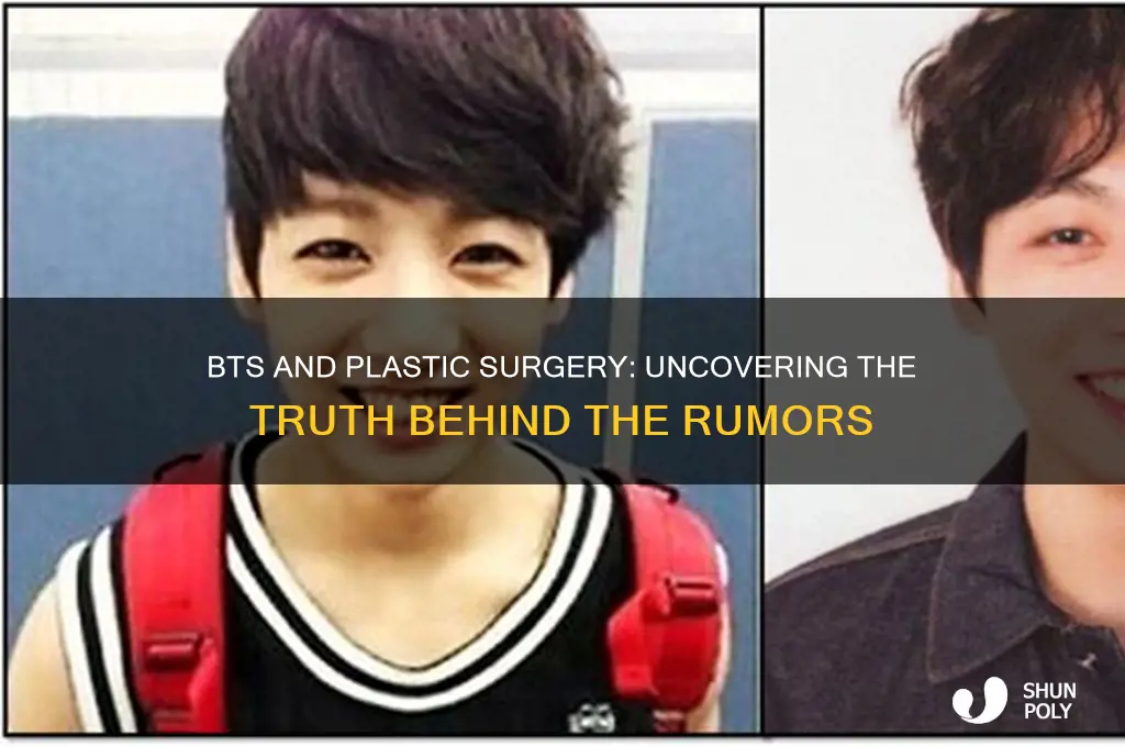 does bts do plastic surgery