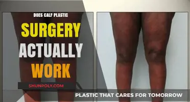 Calf Plastic Surgery: Does It Deliver Real Results and Satisfaction?