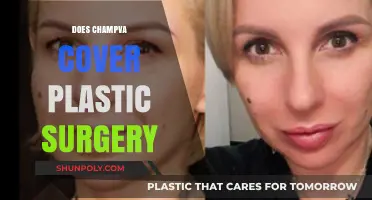Does CHAMPVA Cover Plastic Surgery? Benefits and Limitations Explained