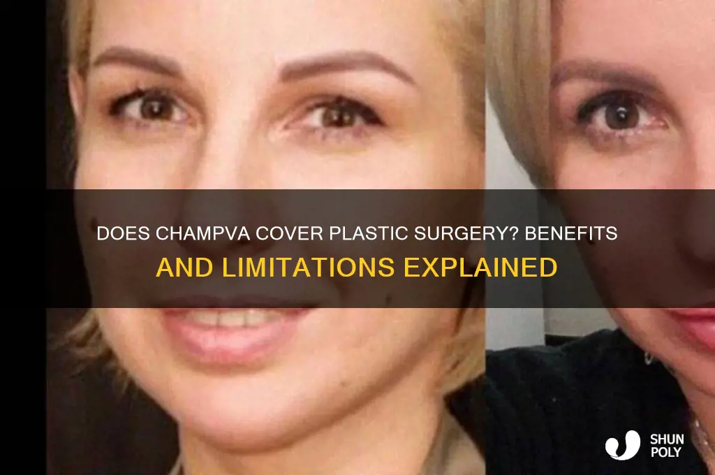 does champva cover plastic surgery