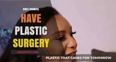 Did Chantel Undergo Plastic Surgery? Uncovering the Truth Behind Her Look
