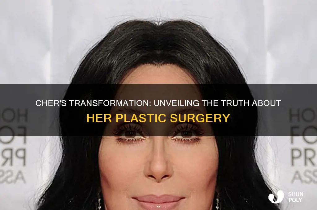 does cher have plastic surgery