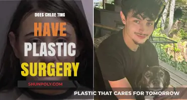 Chloe Ting Plastic Surgery: Fact-Checking the Rumors and Speculations