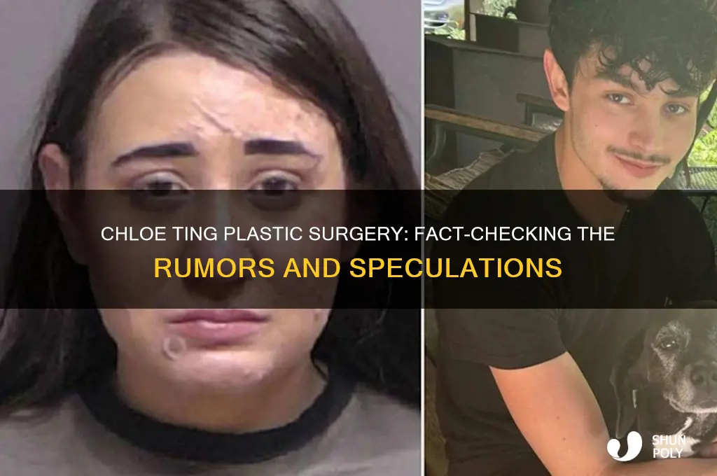 does chloe ting have plastic surgery