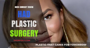 Chrissy Teigen's Transformation: Plastic Surgery Rumors Explored and Debunked