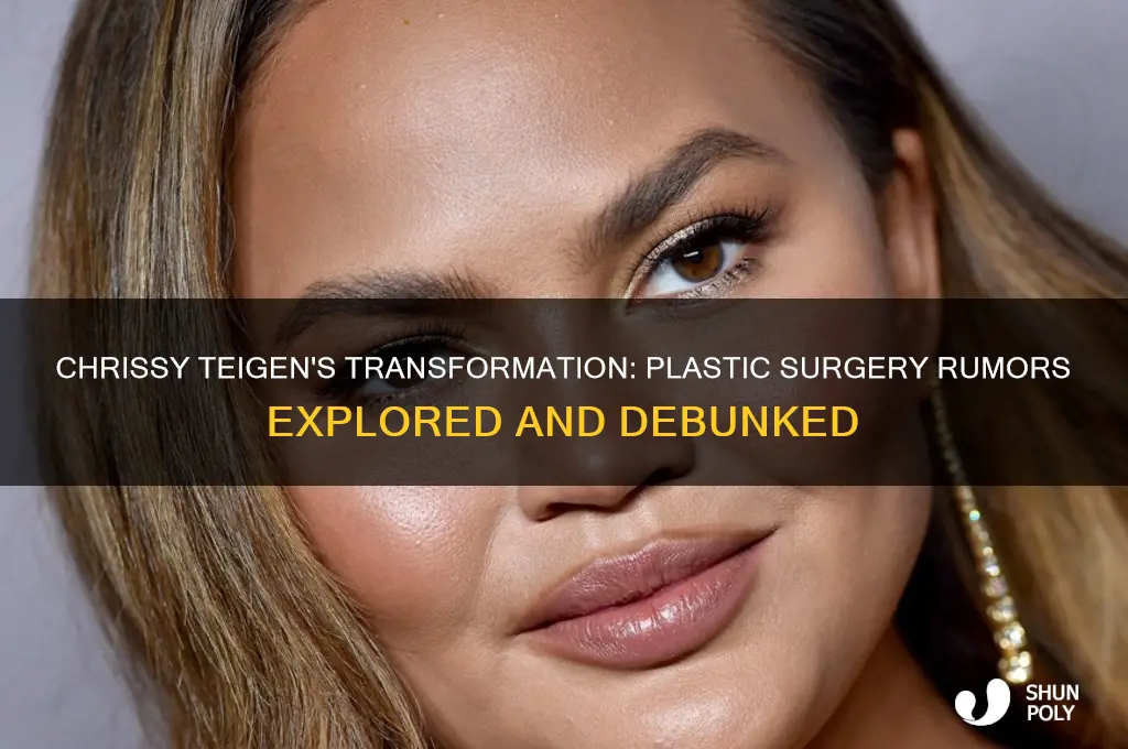 does chrissy teigen had plastic surgery