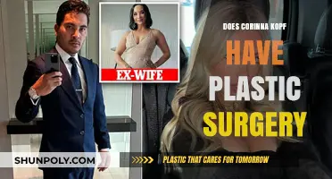 Corinna Kopf's Transformation: Plastic Surgery Rumors Explored and Debunked