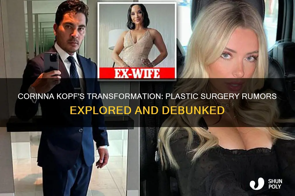 does corinna kopf have plastic surgery