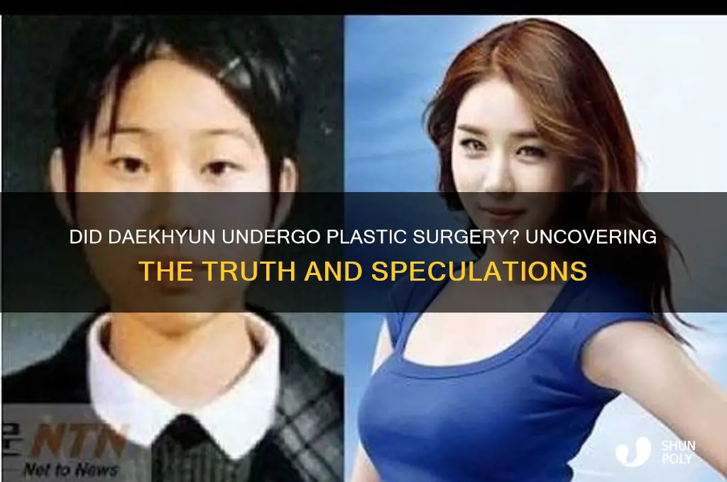 does daekhyun have plastic surgery