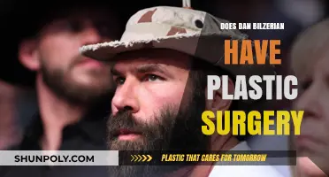 Unveiling Dan Bilzerian's Transformation: Plastic Surgery Rumors Explored