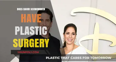 David Schwimmer's Transformation: Plastic Surgery Rumors Explored and Debunked