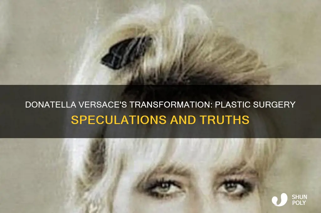 does donatella versace have plastic surgery