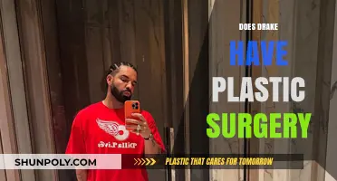 Drake's Transformation: Unveiling the Truth About Plastic Surgery Rumors