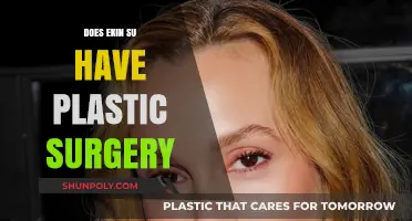 Ekin-Su's Transformation: Unveiling the Truth About Plastic Surgery Rumors