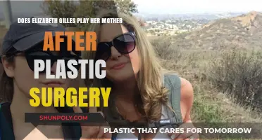 Elizabeth Gillies' Striking Resemblance to Her Mother Post-Plastic Surgery: Coincidence or Transformation?