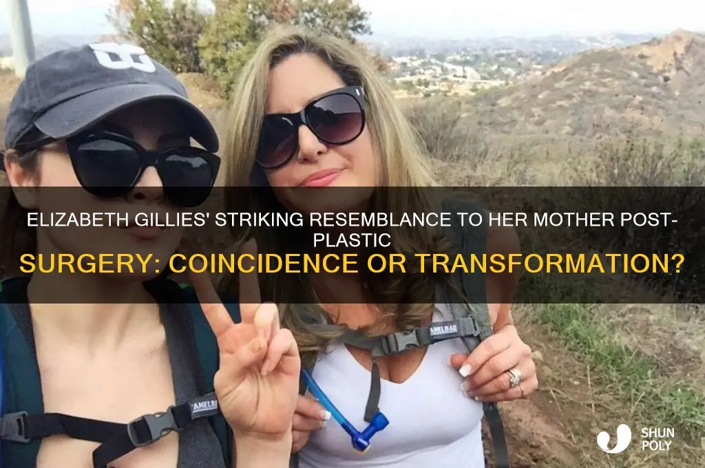 does elizabeth gilles play her mother after plastic surgery