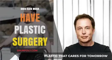 Elon Musk's Transformation: Plastic Surgery Rumors Explored and Debunked