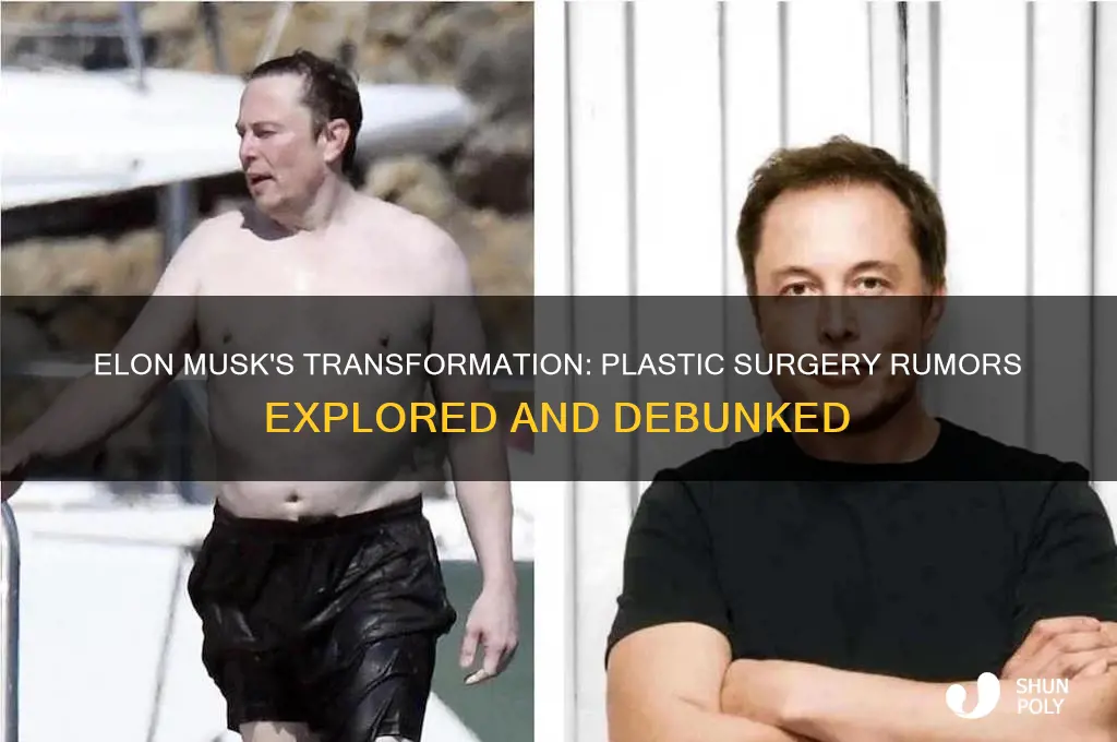 does elon musk have plastic surgery