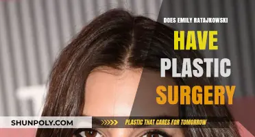 Emily Ratajkowski's Plastic Surgery Speculations: Fact or Fiction?