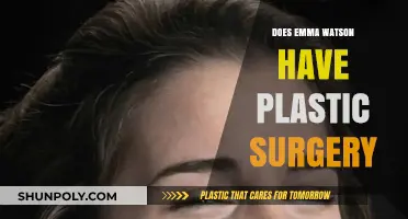 Emma Watson Plastic Surgery: Fact or Fiction? Unveiling the Truth