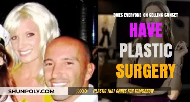 Selling Sunset Stars: Plastic Surgery Truths and Transformations Revealed