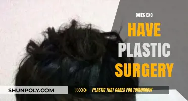 Unveiling the Truth: Did EXO Members Undergo Plastic Surgery?