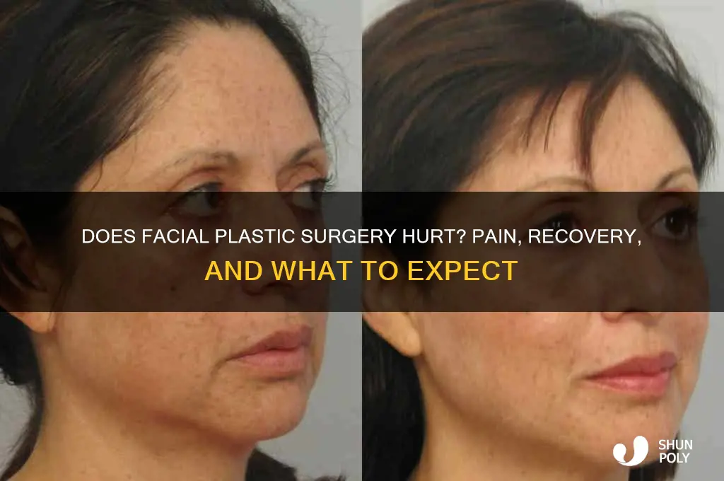 does facial plastic surgery hurt