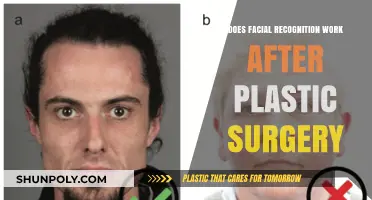 Facial Recognition Post-Plastic Surgery: Does It Still Work?