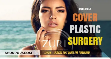 Does FMLA Cover Plastic Surgery? Understanding Job-Protected Leave Eligibility