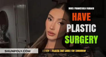 Francesca Farago's Transformation: Plastic Surgery Speculations and Truths