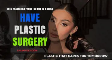 Francesca Farago's Transformation: Plastic Surgery Rumors Explored