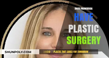 Francesca's Transformation: Unveiling the Truth About Plastic Surgery Rumors